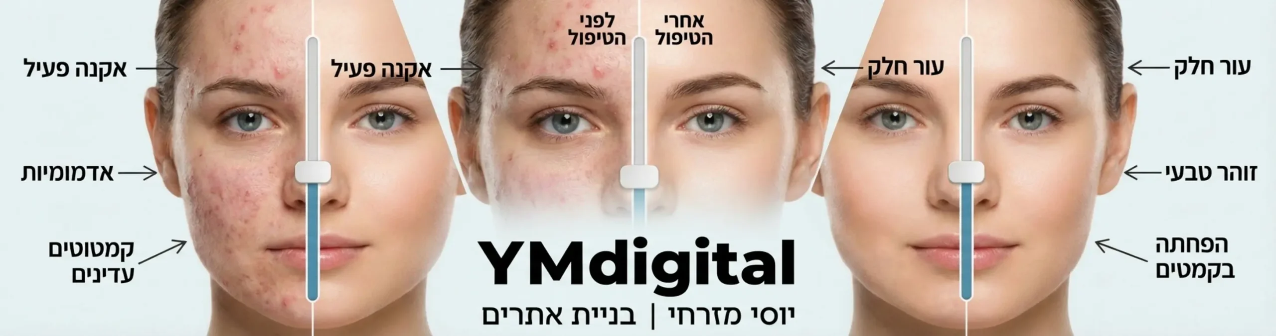 אינפוגרפיקה המציגה תמונה חצויה לשניים עם סליידר באמצע הניתן לגרירה. צד אחד מציג עור עם אקנה או קמטוטים והצד השני מציג עור חלק וזוהר לאחר טיפול, עם הסברים טקסטואליים קטנים המצביעים על השיפורים הספציפיים